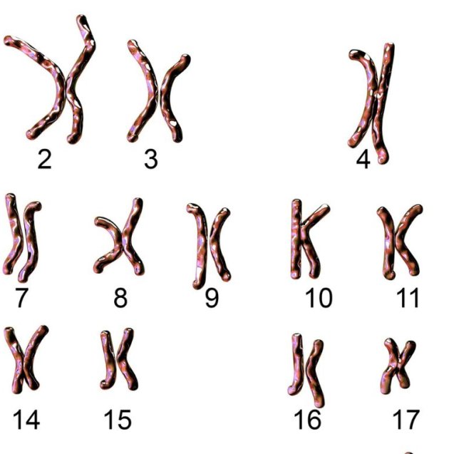 Cariotipo de Médula Ósea