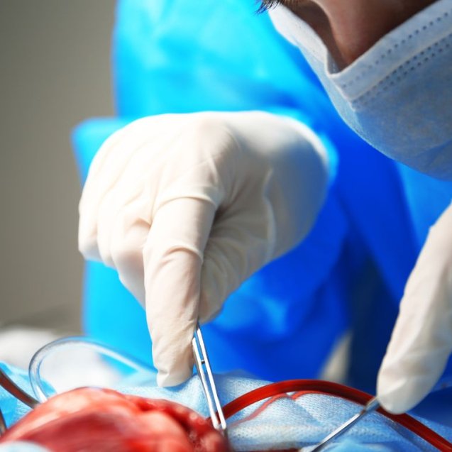 Primer Trasplante de Corazón