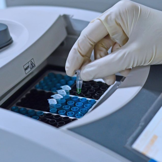 Detección de 28 Alteraciones Cromosómicas por RT-PCR